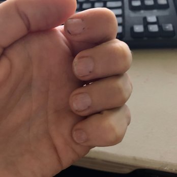 Paris Nail Bar - The way they left my nails - after drilling the gel away and cutting my toes and fingers with the drill multiple times - Nail Salons Near Me - Tucson, Arizona