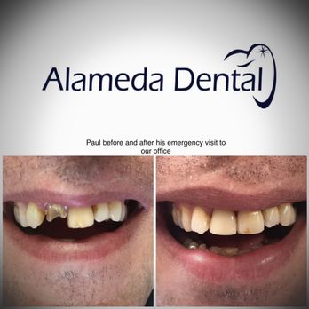 Alameda Dental - Cosmetic Dentists Near Me - Aurora, Colorado Alameda Dental - Cosmetic Dentists Near Me - Aurora, Colorado