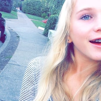 Kirk Orthodontics - Michaela's smile after Dr Kirk magic. - Orthodontists Near Me - Petaluma, California Kirk Orthodontics - Michaela's smile after Dr Kirk magic. - Orthodontists Near Me - Petaluma, California
