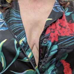 North Texas Plastic Surgery - Does this look like a brand new rack?? Not happy about the amount I spent for this quality