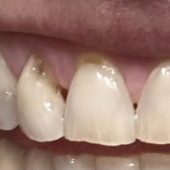 Olive Dental / Lien T Truong, DDS - General Dentistry Near Me - Redlands, California Olive Dental / Lien T Truong, DDS - General Dentistry Near Me - Redlands, California