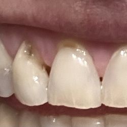 Olive Dental / Lien T Truong, DDS