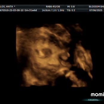 Blossom Baby - My baby boy - Diagnostic Imaging Near Me - Oceanside, California Blossom Baby - My baby boy - Diagnostic Imaging Near Me - Oceanside, California