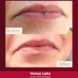 MarSha MedSpa