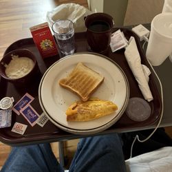 Beachside Center for Rehabilitation and Healthcare - Very hard toast and a very hard cheese omelette it is rolled up with nasty tasty tasting cheese