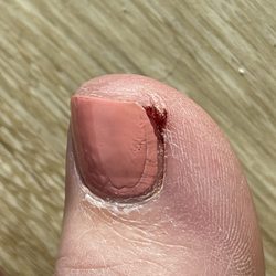Nail Boutique & Spa - 1 day after pedicure. Just waiting for infection to flare up from skin being ripped off