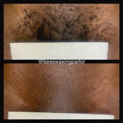 Bee Waxing Parlor - Before and after of a Brazilian wax.