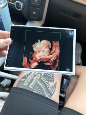 Moon River Ultrasound