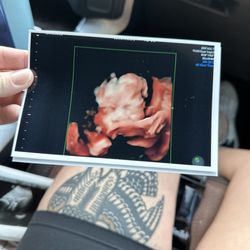 Moon River Ultrasound - Ultrasound print products