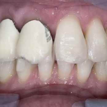 210 Orthodontics - My teeth today - Orthodontists Near Me - San Antonio, Texas 210 Orthodontics - My teeth today - Orthodontists Near Me - San Antonio, Texas