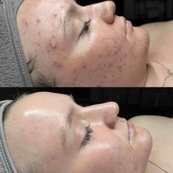 Awaken Aesthetics - 7 months before and after