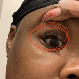 Left eye Wednesday morning Left eye Wednesday morning