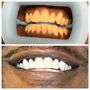 Photo of Sparkling White Smiles - Atlanta