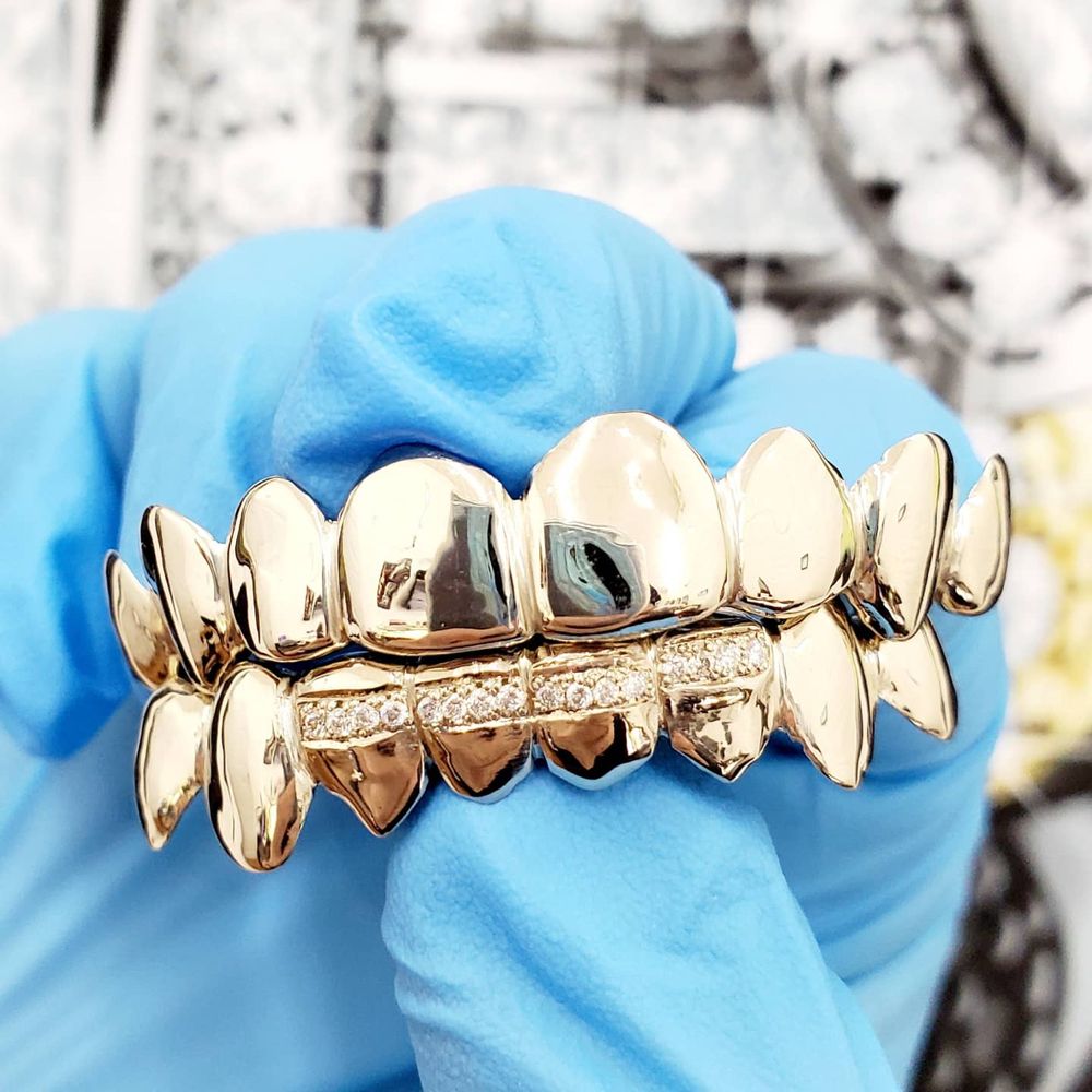 GOLD GRILLZ MIAMI Updated May 2024 214 Photos 1754 NE 163rd St