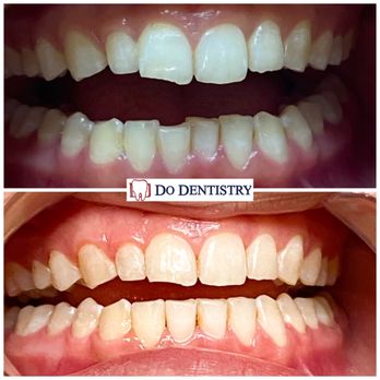 DO DENTISTRY - Endodontists Near Me - Pasadena, California