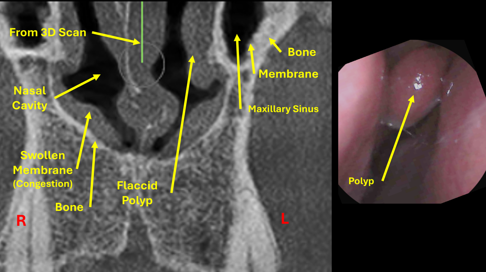 Advanced Sinus Relief Centers - sleep specialist in Goodyear, AZ