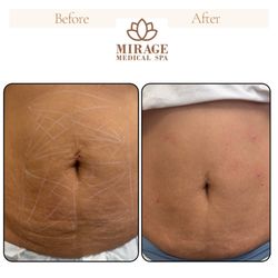 Mirage Medical Spa