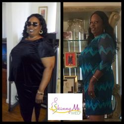 Photo of Skinny Me Med - Van Nuys, CA, US. Another amazing success story, Sharon started her weight loss with Skinny Me Med in May 2017 & as of October 2017, she has lost 65lbs!!