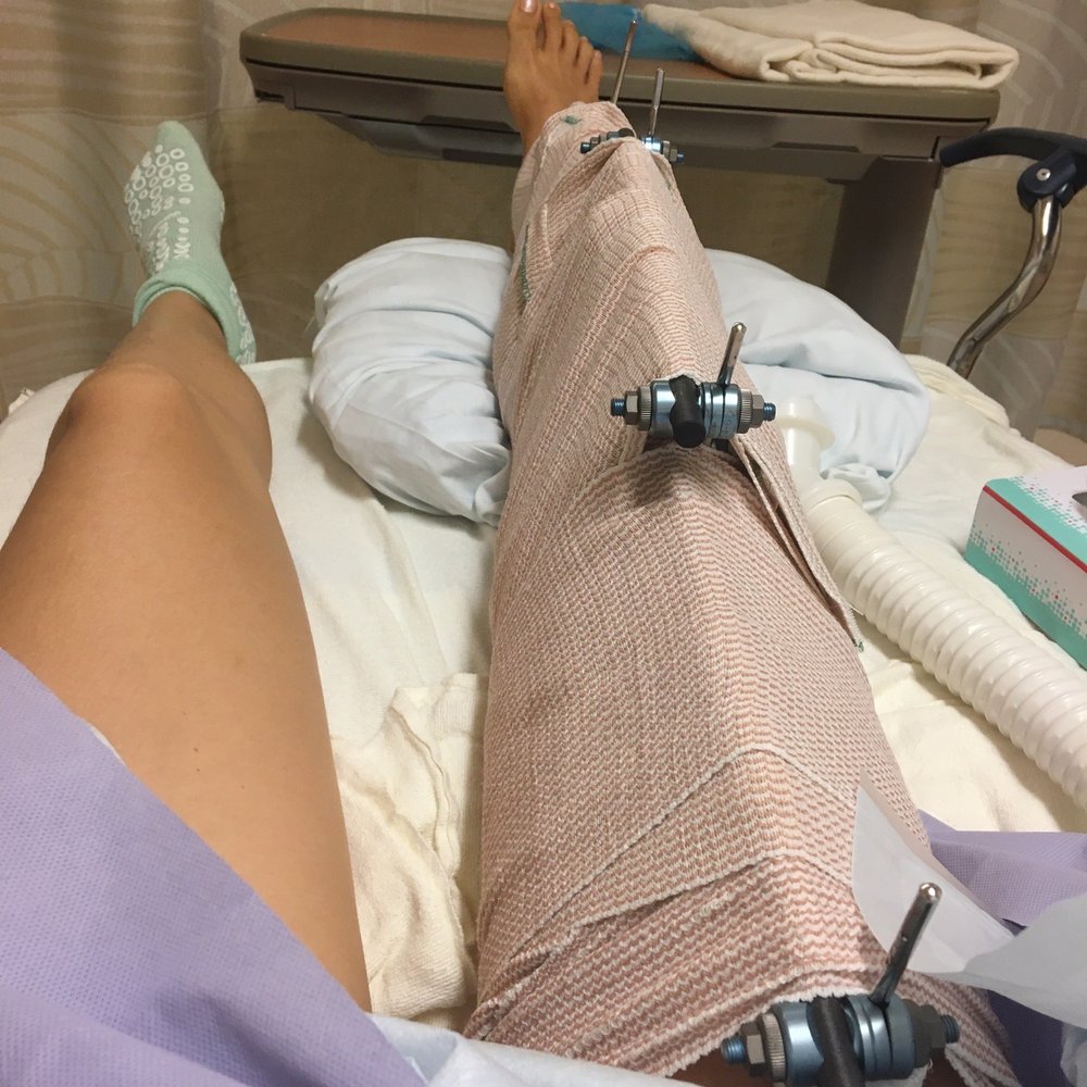 Modern Orthopedics PC - Orthopedists Near Me - Los Gatos, California