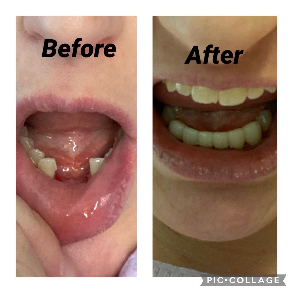 RESTON FAMILY & COSMETIC DENTISTRY Updated October 2024 52 Reviews 1984 Isaac Newton Sq W