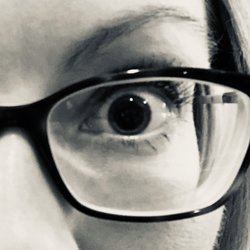 Southeastern Retina Specialists - Dilation before laser work