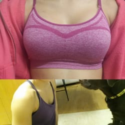 Dr. Arturo González Montes - The bottom is a photo of me before and the top is me at only 2 weeks post op!