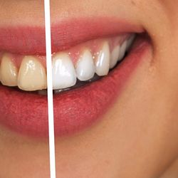 Az Dental