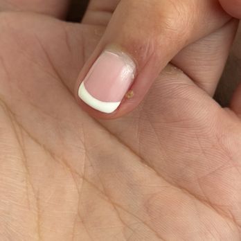 Gala Nail Salon - My finger was very swollen this is after a few days, you can still see dried pus and swollen from the cut even after days. - Nail Salons Near Me - Los Angeles, California Gala Nail Salon - My finger was very swollen this is after a few days, you can still see dried pus and swollen from the cut even after days. - Nail Salons Near Me - Los Angeles, California