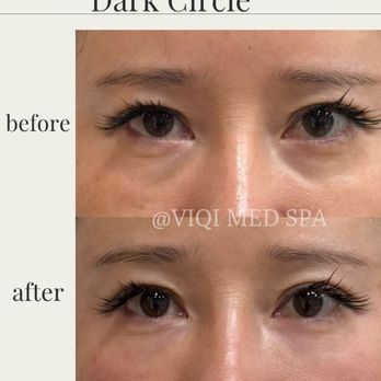 VIQI Med Spa - Medical Spas Near Me - Alhambra, California