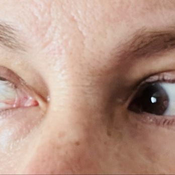 Sabi Brows & Beauty - Before my lift and tint (pardon my red eyes) ;) - Eyelash Service Near Me - Austin, Texas Sabi Brows & Beauty - Before my lift and tint (pardon my red eyes) ;) - Eyelash Service Near Me - Austin, Texas