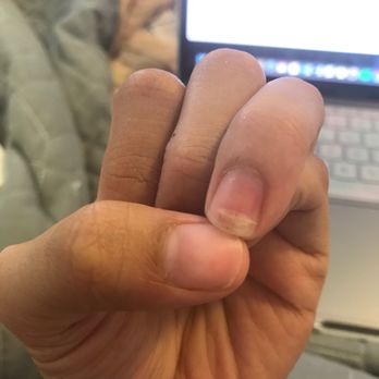A & A Nails Salon - Where they cut my nail and told me that I cut it that's why it hurts when I dip it in the solution. - Nail Salons Near Me - Honolulu, Hawaii A & A Nails Salon - Where they cut my nail and told me that I cut it that's why it hurts when I dip it in the solution. - Nail Salons Near Me - Honolulu, Hawaii