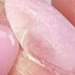 This is NOT my nail but this is similar what happened.