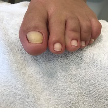 Revive With Thi - This photo was taken today June 19, 2018 and I'm so happy with my results. Thank you Thi!!! - Nail Technicians Near Me - Los Angeles, California Revive With Thi - This photo was taken today June 19, 2018 and I'm so happy with my results. Thank you Thi!!! - Nail Technicians Near Me - Los Angeles, California