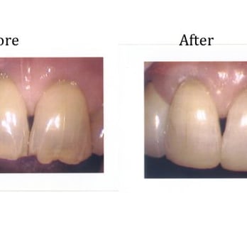 Irving J Leonard, DDS - Oral Surgeons Near Me - Chicago, Illinois