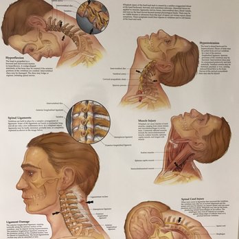 Gentle Chiropractic Care - Chiropractors Near Me - Sunnyvale, California