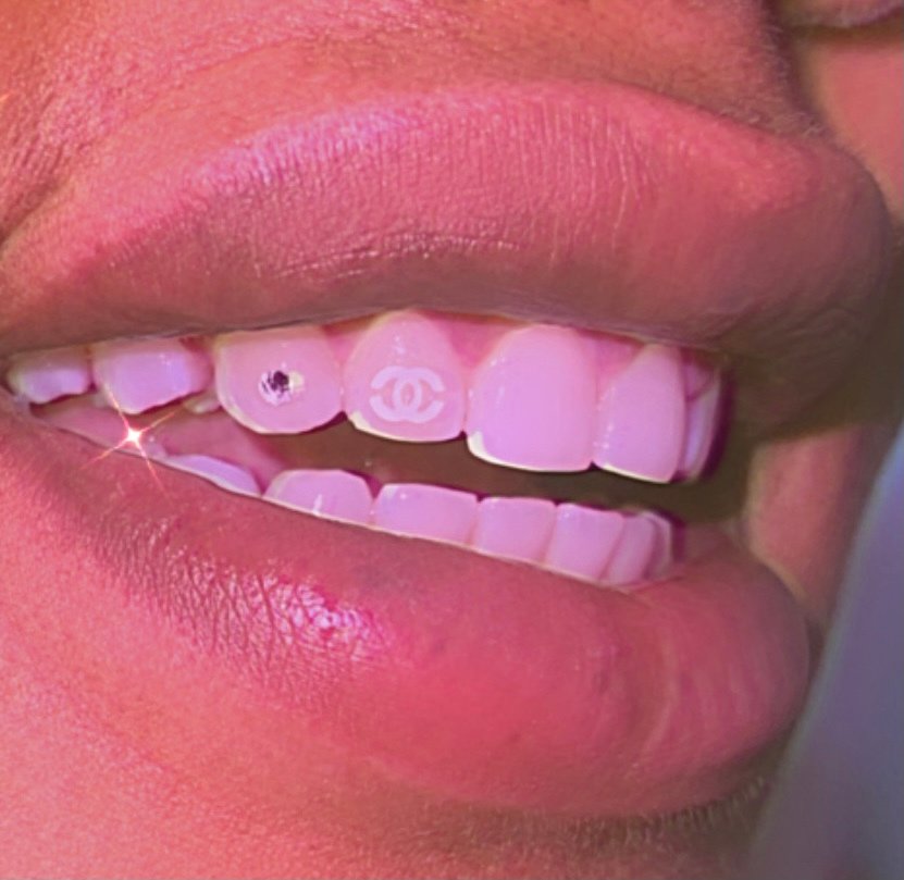 LUXE LIONI SPA 21 Photos San Francisco, California Teeth