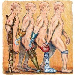 Gatewood Prosthetics