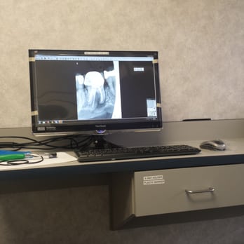 Judy Chen, DDS - Xray of tooth - Endodontists Near Me - Milpitas, California