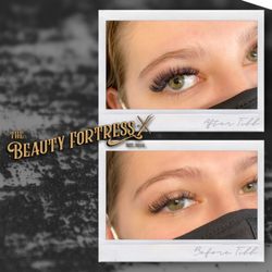 The Beauty Fortress - 3 Week Light Volume Fill