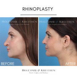 Holcomb Kreithen Plastic Surgery and MedSpa