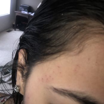 Doll's Salon & Spa - I have cuts all over my forehead and around my eyebrows.. - Hair Salons Near Me - Naperville, Illinois