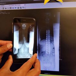 Kenneth T Kaan, MD - Before and after
