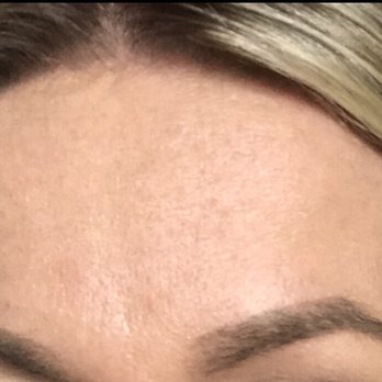 Rejuvenate Rx - Botox working - Medical Spas Near Me - Spokane, Washington Rejuvenate Rx - Botox working - Medical Spas Near Me - Spokane, Washington