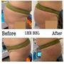 Photo of Body Sculpting Chula Vista & Spa