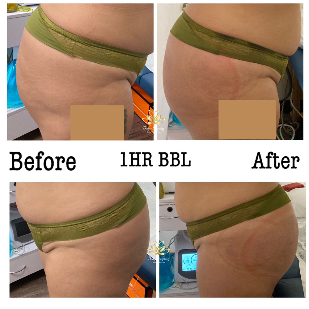 Body Sculpting Chula Vista & Spa Logo