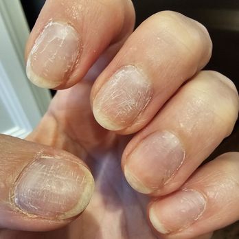 Robinson Nail Spa - Immediately removed terrible polish to see the damage. Zero stars. - Nail Salons Near Me - Pittsburgh, Pennsylvania