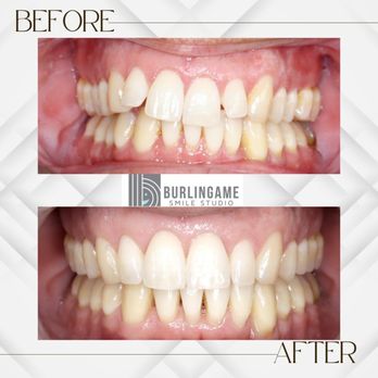 Burlingame Smile Studio - Orthodontists Near Me - Burlingame, California Burlingame Smile Studio - Orthodontists Near Me - Burlingame, California