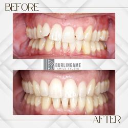 Burlingame Smile Studio