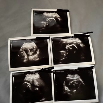 Ultrasound Services - Ultrasound Imaging Centers Near Me - Santa Ana, California Ultrasound Services - Ultrasound Imaging Centers Near Me - Santa Ana, California