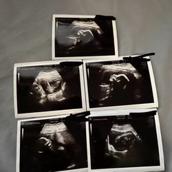 Ultrasound Services